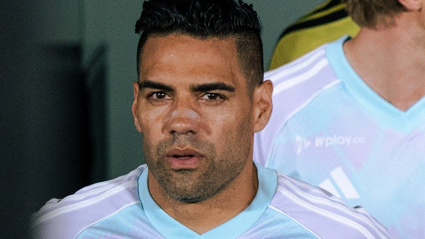 Millonarios confirma que Falcao García no requiere cirugía para tratar lesión en el rostro