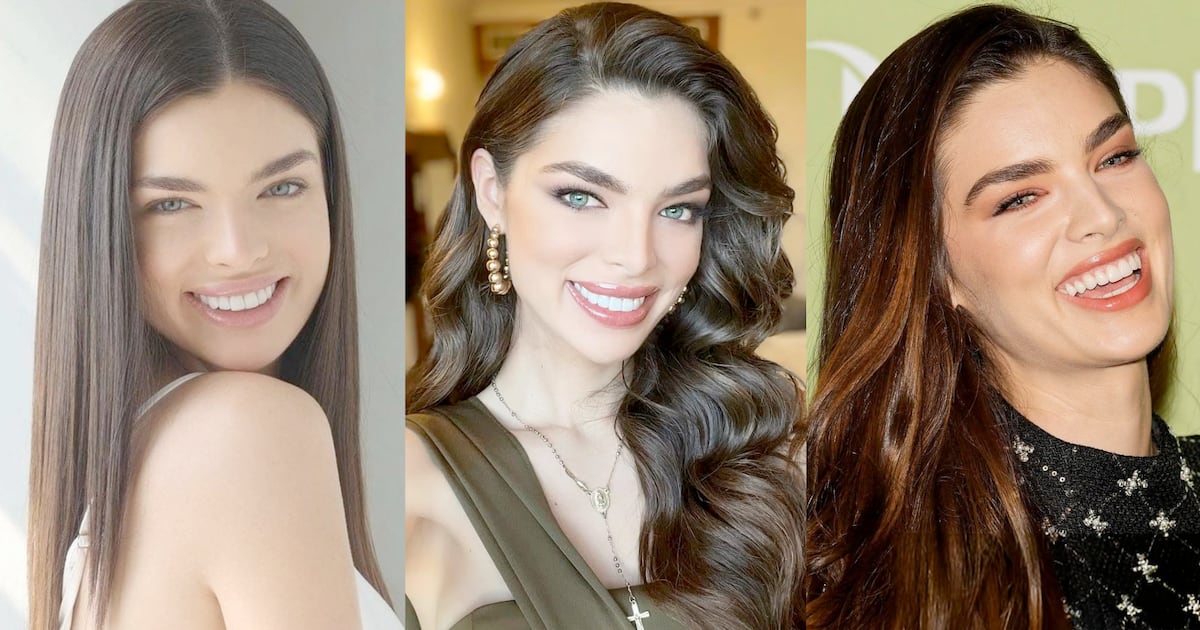 Perfección plástica a la naturalidad: el cambio de las carillas de Nadia Ferreira