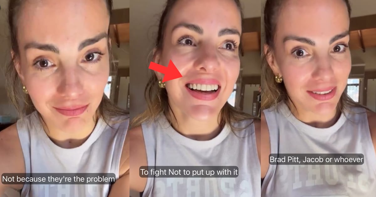 Bigote de carne: preocupa supuesto lip filler migrado de Maga Páez